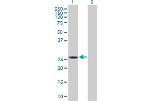 Western Blot analysis of SPR expression in transfected 293T cell line by SPR MaxPab polyclonal antibody. (SPR Antikörper  (AA 1-261))