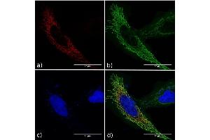 Immunofluorescence staining of fixed HeLa cells expressing mCherry tagged GCN4 with anti-GCN4 antibody C11L34. (Rekombinanter GCN4 Antikörper)