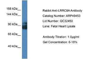 WB Suggested Anti-LRRC8A Antibody Titration:  0.
