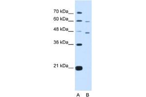 WB Suggested Anti-CRELD1 Antibody Titration:  5.