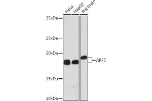 Western blot analysis of extracts of various cell lines, using  Rabbit mAb (ABIN7265484) at 1:1000 dilution. (ARF5 Antikörper)