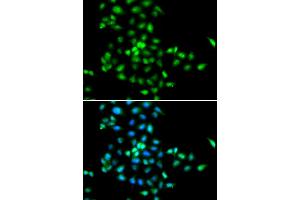 Immunofluorescence analysis of MCF-7 cells using SBDS antibody.