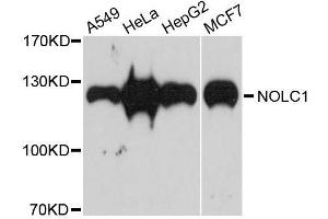 Western blot analysis of extracts of various cell lines, using NOLC1 antibody. (NOLC1 Antikörper  (AA 400-699))