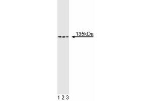 Western blot analysis of TAF[II] 135 on Jurkat lysate. (TAF4 Antikörper  (AA 454-565))