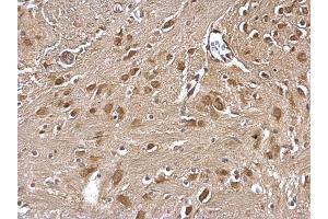IHC-P Image GLMN antibody detects GLMN protein at cytosol on mouse fore brain by immunohistochemical analysis. (GLMN Antikörper)