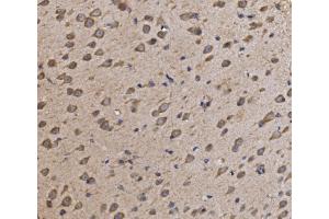 IHC analysis of NDUFAF1 using anti-NDUFAF1 antibody (ABIN7602459).