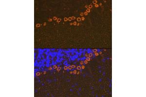 Immunofluorescence analysis of mouse brain using IP3R Rabbit mAb (ABIN1679064, ABIN3018927, ABIN3018928 and ABIN7101690) at dilution of 1:100 (40x lens). (ITPR1 Antikörper)