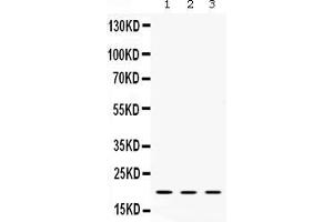 Western blot analysis of Alpha A Crystallin expression in rat spleen extract ( Lane 1), mouse eye ball extract ( Lane 2) and SMMC7721 whole cell lysates ( Lane 3). (CRYAA Antikörper  (AA 1-173))