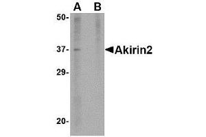 Image no. 1 for anti-Akirin 2 (AKIRIN2) (Internal Region) antibody (ABIN342720) (AKIRIN2 Antikörper  (Internal Region))