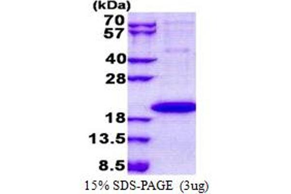 IL1F9 Protein (AA 1-169) (His tag)