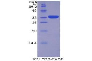 SDS-PAGE (SDS) image for TNF Receptor-Associated Factor 5 (TRAF5) (AA 181-437) protein (His tag) (ABIN2126980)