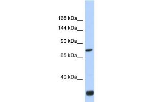 Western Blotting (WB) image for anti-Fibronectin Type III Domain Containing 3A (FNDC3A) (N-Term) antibody (ABIN2782102)