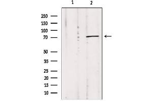 Western blot analysis of extracts from Mouse Myeloma cell, using MPP5 antibody. (MPP5 Antikörper  (C-Term))