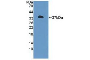 Western blot analysis of recombinant Human P2RX7. (P2RX7 Antikörper  (AA 47-334))