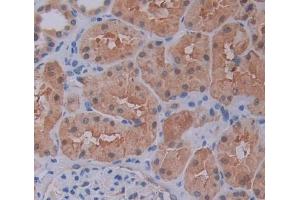 Immunohistochemistry (IHC) image for anti-Host Cell Factor C1 (VP16-Accessory Protein) (HCFC1) (AA 52-258) antibody (ABIN5013712)