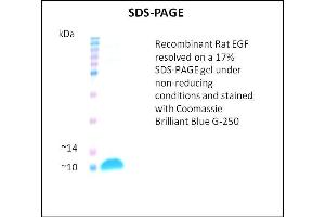 SDS-PAGE (SDS) image for Epidermal Growth Factor (EGF) (Active) protein (ABIN5509414) (EGF Protein)