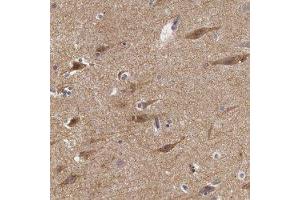Immunohistochemical staining of human cerebral cortex with NLGN4X polyclonal antibody  shows moderate cytoplasmic positivity in neuronal cells at 1:50-1:200 dilution. (Neuroligin 4 Antikörper)