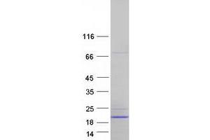 Western Blotting (WB) image for ATP synthase subunit delta, mitochondrial (ATP5F1D) (Transcript Variant 2) protein (Myc-DYKDDDDK Tag) (ABIN2715046)