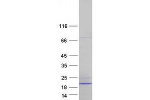 Validation with Western Blot (ATP5F1D Protein (Transcript Variant 2) (Myc-DYKDDDDK Tag))