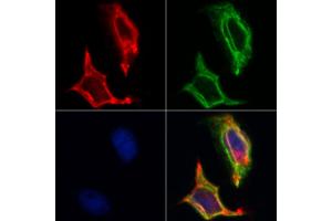 ABIN6262608 and ABIN6268730 staining Hela by IF/ICC.