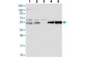 Western blot analysis of Lane 1: RT-4, Lane 2: U-251 MG, Lane 3: Human Plasma, Lane 4: Liver, Lane 5: Tonsil with PRRC1 polyclonal antibody . (PRRC1 Antikörper)
