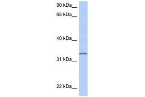 C3ORF62 antibody used at 1 ug/ml to detect target protein.