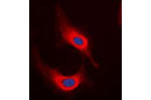 Immunofluorescent analysis of Desmin staining in HeLa cells. (Desmin Antikörper  (C-Term))
