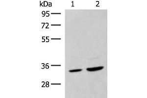 Western blot analysis of Hela cell and Human fetal liver tissue lysates using SCGN Polyclonal Antibody at dilution of 1:600 (SCGN Antikörper)