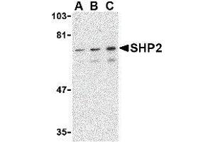 Western Blotting (WB) image for anti-Protein tyrosine Phosphatase, Non-Receptor Type 11 (PTPN11) (C-Term) antibody (ABIN2476469) (PTPN11 Antikörper  (C-Term))