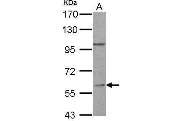 RGS14 Antikörper  (C-Term)