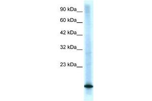 Western Blotting (WB) image for anti-Cyclin-Dependent Kinase Inhibitor 2B (p15, Inhibits CDK4) (CDKN2B) (Middle Region) antibody (ABIN926911)