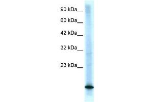 CDKN2B antibody (70R-10487) used at 0. (CDKN2B Antikörper  (Middle Region))