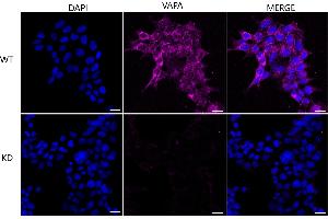 anti-VAMP (Vesicle-Associated Membrane Protein)-Associated Protein A, 33kDa (VAPA) antibody