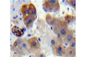 Used in DAB staining on fromalin fixed paraffin-embedded Liver tissue (PLA2G6 Antikörper  (AA 481-702))
