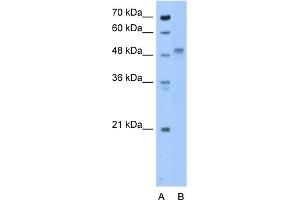 WB Suggested Anti-ZP4 Antibody Titration:  0. (ZP4 Antikörper  (N-Term))