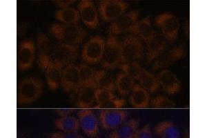 Immunofluorescence analysis of HeLa cells using RPL23A Polyclonal Antibody at dilution of 1:100.