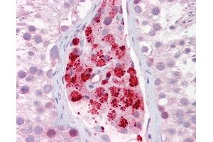 Anti-AURKA / Aurora-A antibody IHC of human testis. (Aurora A Antikörper  (AA 100-150))