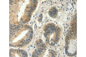 Immunohistochemistry (IHC) image for anti-Suppressor of Cytokine Signaling 5 (SOCS5) antibody (ABIN2428731) (SOCS5 Antikörper)