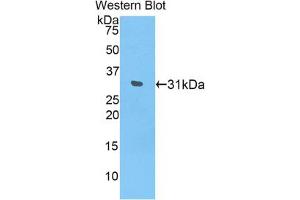 Western blot analysis of the recombinant protein. (IL17RD Antikörper  (AA 356-603))