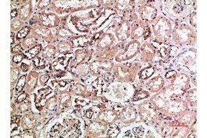 Immunohistochemical analysis of paraffin-embedded human-kidney, antibody was diluted at 1:200 (KIR2DL5A Antikörper  (AA 121-170))