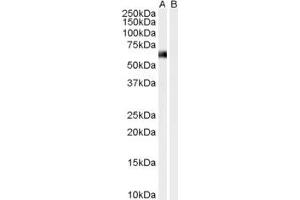 Western Blotting (WB) image for anti-Syntrophin, alpha 1 (Dystrophin-Associated Protein A1, 59kDa, Acidic Component) (SNTA1) (N-Term) antibody (ABIN2465307) (SNTA1 Antikörper  (N-Term))