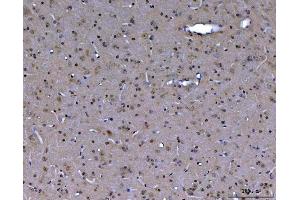 IHC analysis of ABL2 using anti-ABL2 antibody (ABIN4886412).