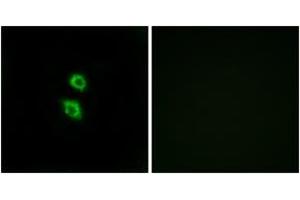 Immunofluorescence analysis of MCF7 cells, using ARSD Antibody. (Arylsulfatase D Antikörper  (AA 331-380))