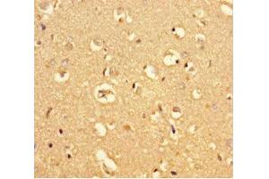 Immunohistochemistry of paraffin-embedded human brain tissue using ABIN7159225 at dilution of 1:100 (MRAP2 Antikörper  (AA 66-205))