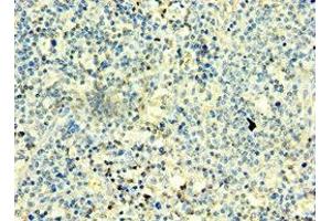 Immunohistochemistry of paraffin-embedded human thyroid tissue using ABIN7171313 at dilution of 1:100 (T-Box 22 Antikörper  (AA 291-520))