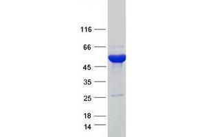 Validation with Western Blot (AGXT2L1 Protein (Myc-DYKDDDDK Tag))