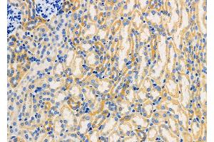 ABIN6259791 and ABIN6266850 at 1/100 staining Mouse kidney tissue by IHC-P. (ADCK1 Antikörper  (Internal Region))