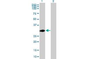 Western Blot analysis of CENPP expression in transfected 293T cell line by CENPP MaxPab polyclonal antibody. (CENPP Antikörper  (AA 1-288))