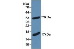 Detection of Recombinant MBP, Mouse using Polyclonal Antibody to Myelin Basic Protein (MBP)