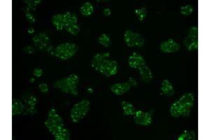 Image no. 5 for anti-Hexokinase 2 (HK2) antibody (ABIN1498647)
